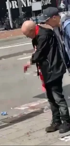 Fan Loses Finger due to Fans Rage